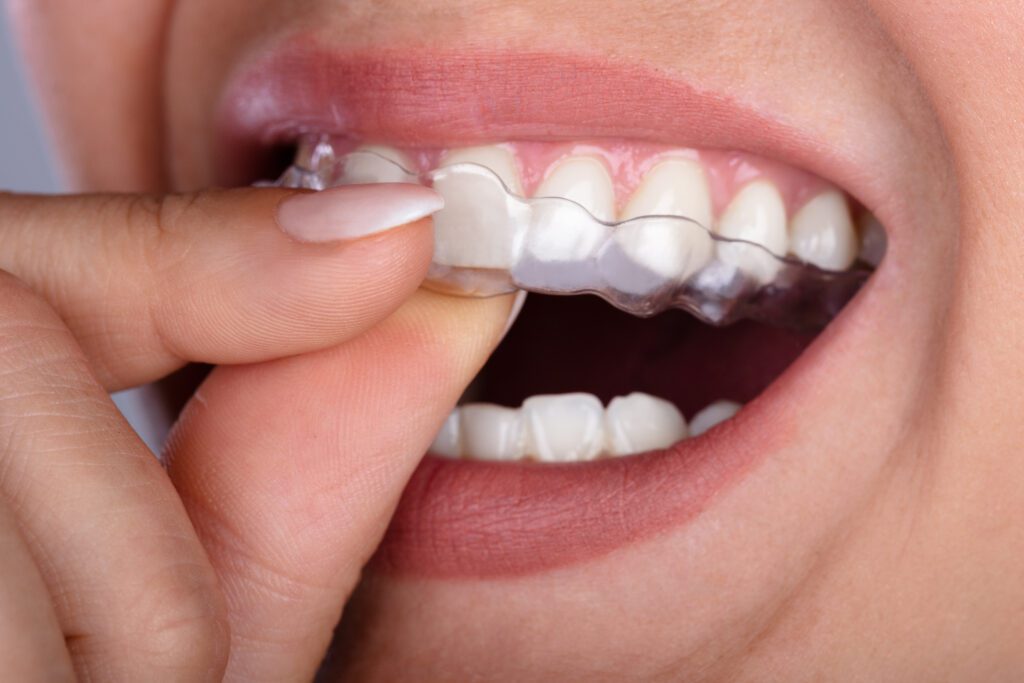 Waterloo Smiles Dentistry -